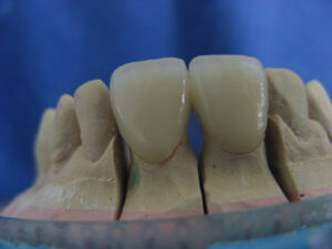 3MPF01103