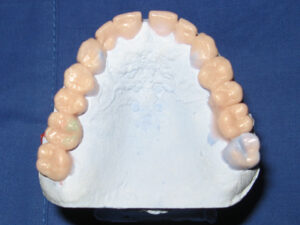 Modellazione diagnostica