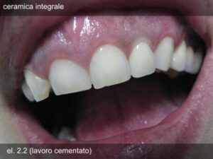 deliv9_10
