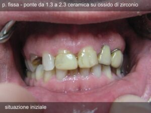 deliv9_11