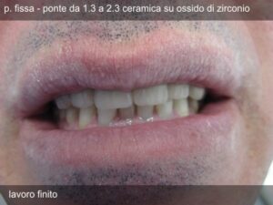 deliv9_17