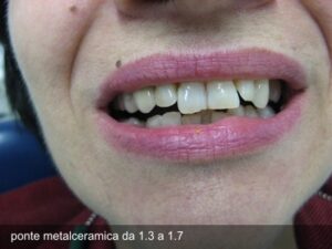 deliv9_4